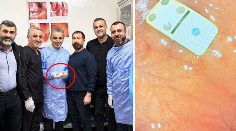 SILÊMANÎ - Pûlekî domînoyê ji mîdeyê xortekî hat...