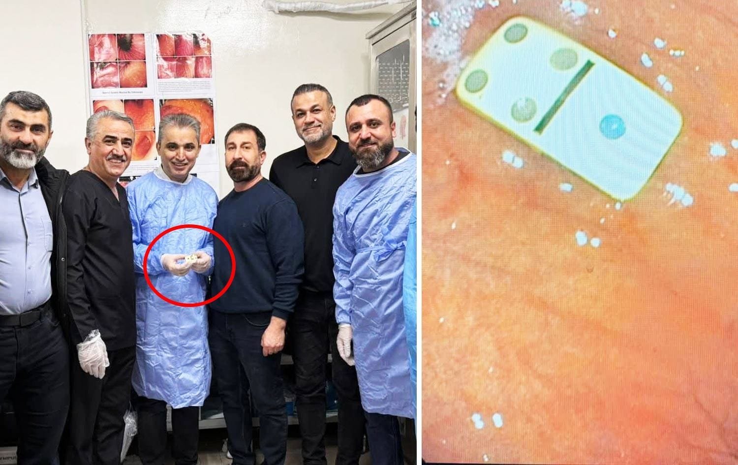 SILÊMANÎ – Pûlekî domînoyê ji mîdeyê xortekî hat…